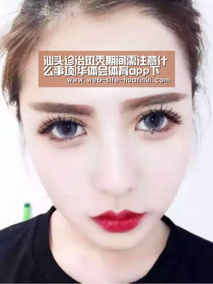 汕头诊治斑秃期间需注意什么事项|华体会体育app下载(图2) 华体会官网下载